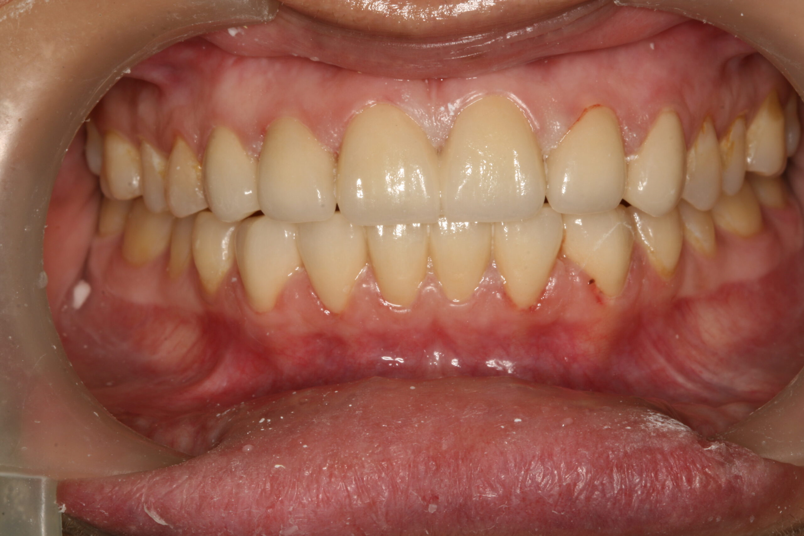 After-Dental-1